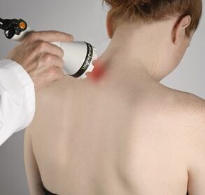 Lazer tedavisi iltihabı hafifletmeye ve boyundaki doku yenilenmesini etkinleştirmeye yardımcı olacaktır