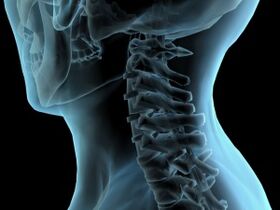 osteokondrozlu servikal vertebra