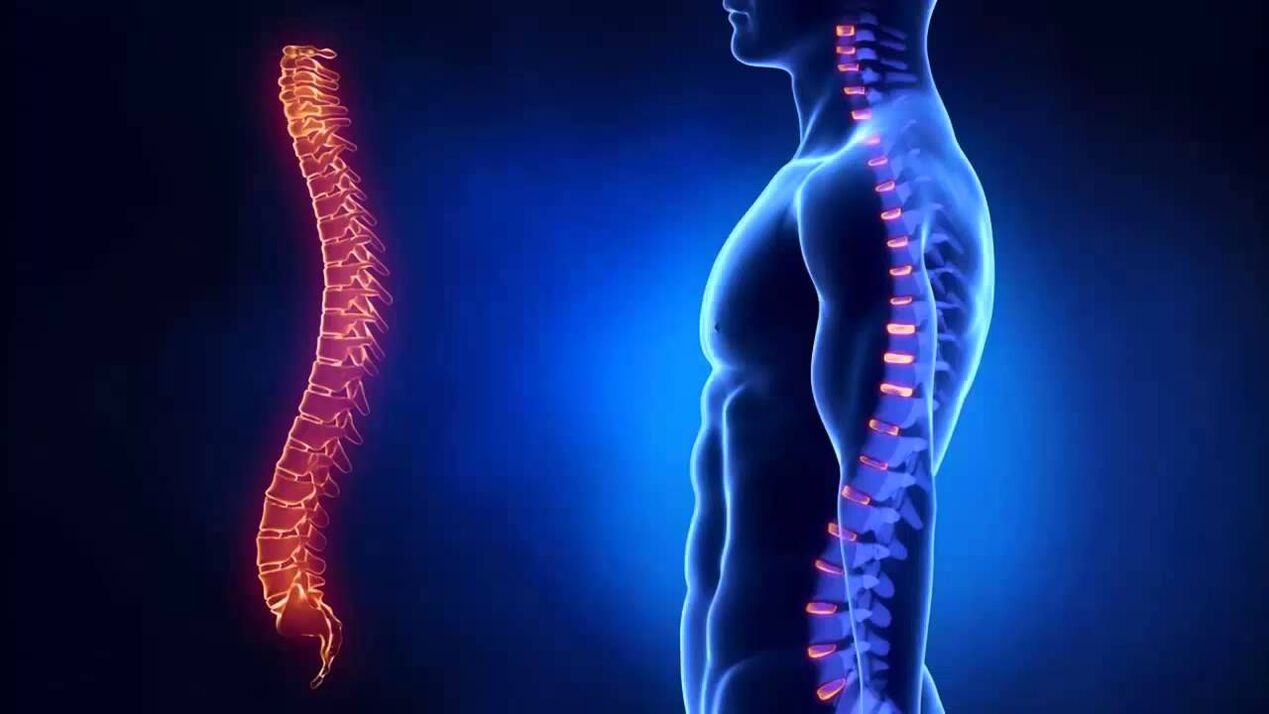 osteokondroz